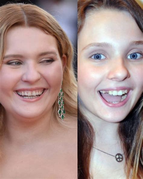 Abigail Breslin Teeth: The Evolution of Her Smile